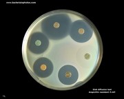 disk diffusion test with escherichia coli